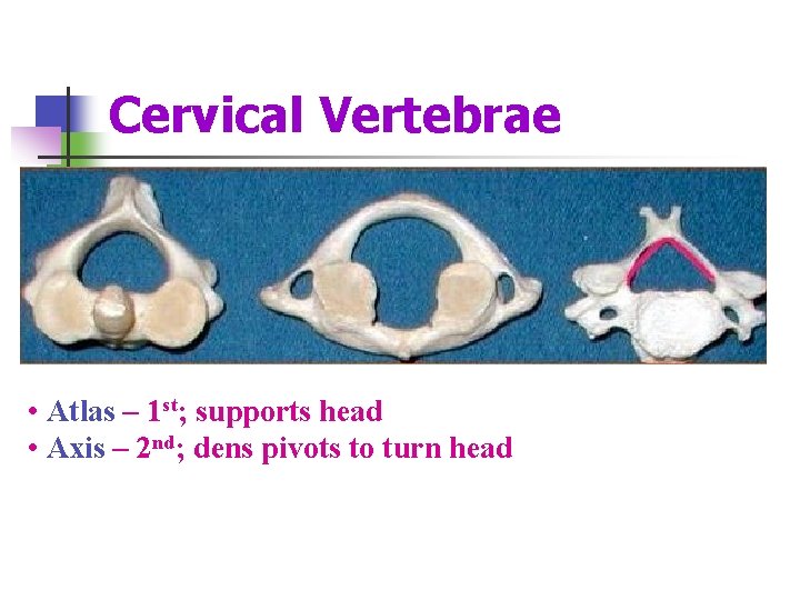Cervical Vertebrae • Atlas – 1 st; supports head • Axis – 2 nd;
