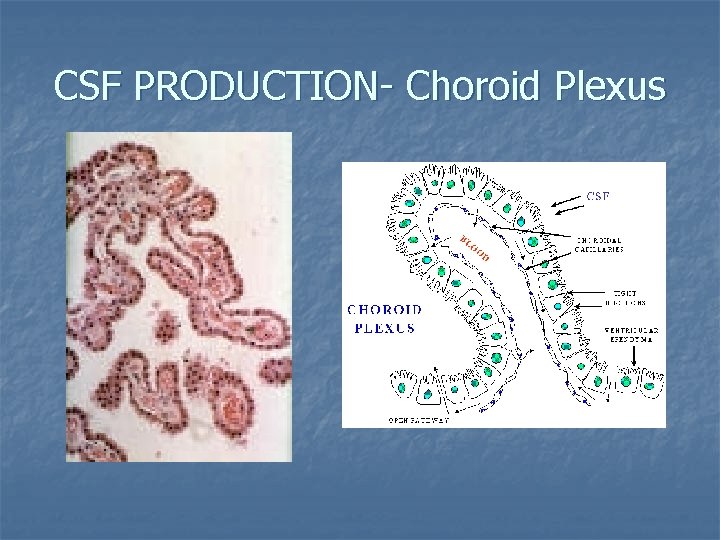 CSF PRODUCTION- Choroid Plexus 