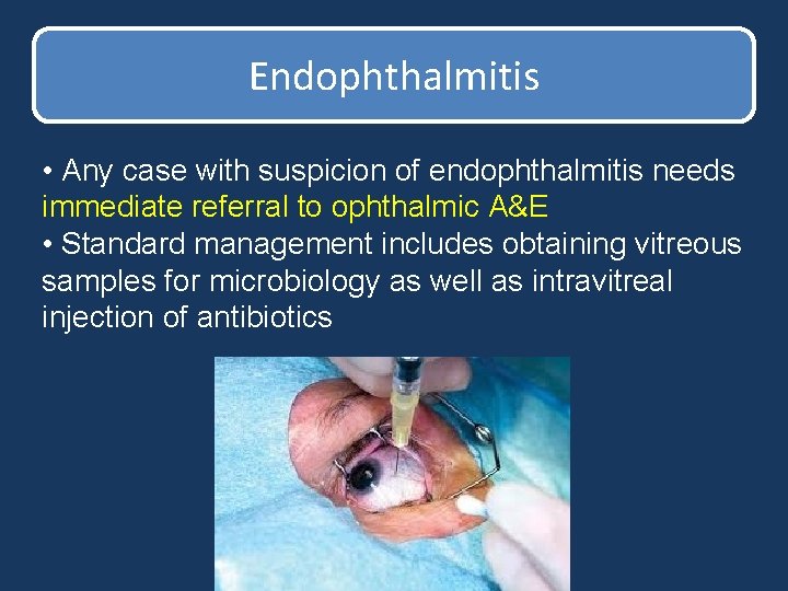 Endophthalmitis • Any case with suspicion of endophthalmitis needs immediate referral to ophthalmic A&E Endophthalmitis • Any case with suspicion of endophthalmitis needs immediate referral to ophthalmic A&E