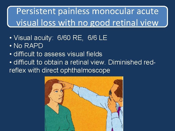 Persistent painless monocular acute visual loss with no good retinal view • Visual acuity: Persistent painless monocular acute visual loss with no good retinal view • Visual acuity: