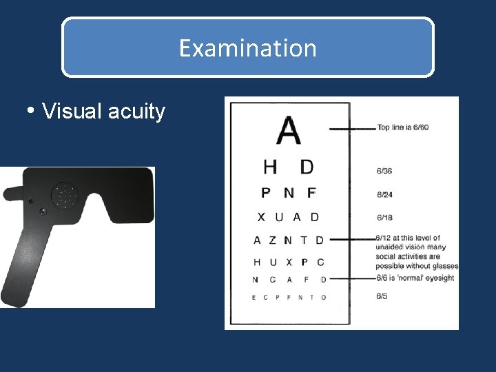 Examination • Visual acuity Examination • Visual acuity