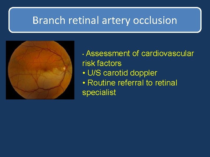 Branch retinal artery occlusion • Assessment of cardiovascular risk factors • U/S carotid doppler Branch retinal artery occlusion • Assessment of cardiovascular risk factors • U/S carotid doppler