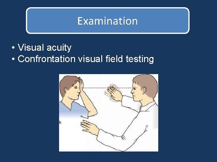 Examination • Visual acuity • Confrontation visual field testing Examination • Visual acuity • Confrontation visual field testing