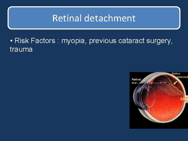 Retinal detachment • Risk Factors : myopia, previous cataract surgery, trauma Retinal detachment • Risk Factors : myopia, previous cataract surgery, trauma