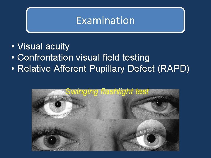 Examination • Visual acuity • Confrontation visual field testing • Relative Afferent Pupillary Defect Examination • Visual acuity • Confrontation visual field testing • Relative Afferent Pupillary Defect