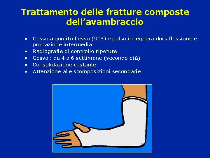 Trattamento delle fratture composte dell’avambraccio • • • Gesso a gomito flesso (90°) e