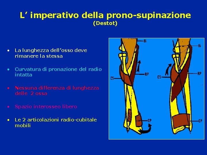 L’ imperativo della prono-supinazione (Destot) • La lunghezza dell’osso deve rimanere la stessa •