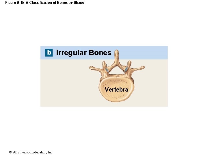 Figure 6 -1 b A Classification of Bones by Shape Irregular Bones Vertebra ©