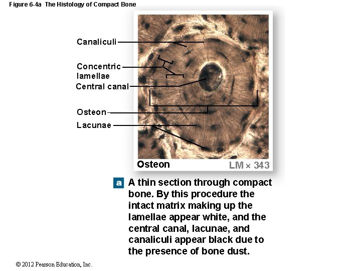 Figure 6 -4 a The Histology of Compact Bone Canaliculi Concentric lamellae Central canal