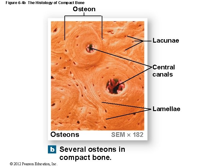 Figure 6 -4 b The Histology of Compact Bone Osteon Lacunae Central canals Lamellae