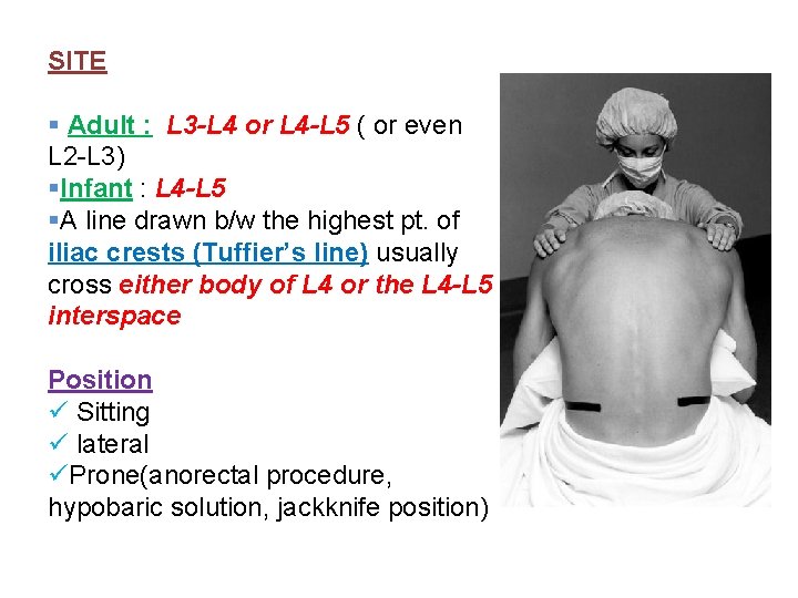 SITE § Adult : L 3 -L 4 or L 4 -L 5 (