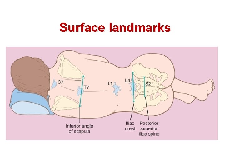 Surface landmarks 