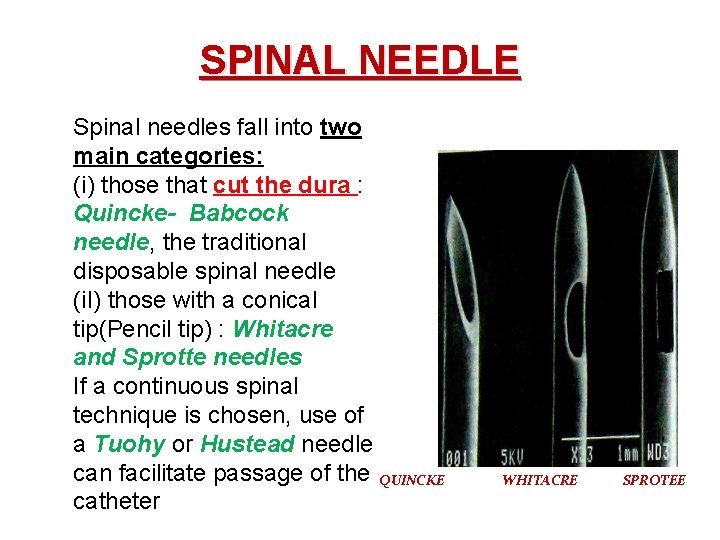 SPINAL NEEDLE Spinal needles fall into two main categories: (i) those that cut the