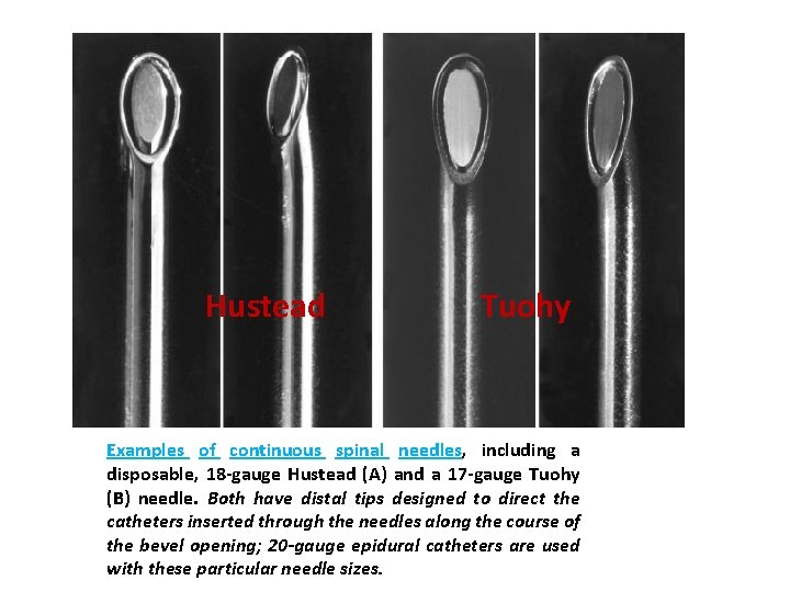 Hustead Tuohy Examples of continuous spinal needles, including a disposable, 18 -gauge Hustead (A)