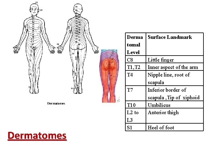 Derma tomal Level C 8 T 1, T 2 T 4 T 7 Dermatomes