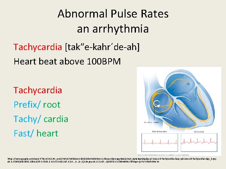 Abnormal Pulse Rates an arrhythmia Tachycardia [tak″e-kahr´de-ah] Heart beat above 100 BPM Tachycardia Prefix/