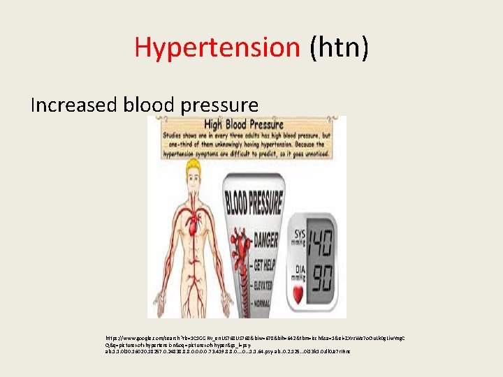 Hypertension (htn) Increased blood pressure https: //www. google. com/search? rlz=1 C 1 GGRV_en. US