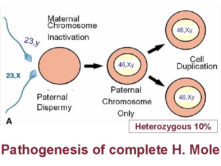 Heterozygous 10% Pathogenesis of complete H. Mole 