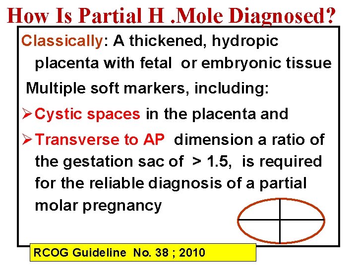 How Is Partial H. Mole Diagnosed? Classically: A thickened, hydropic placenta with fetal or