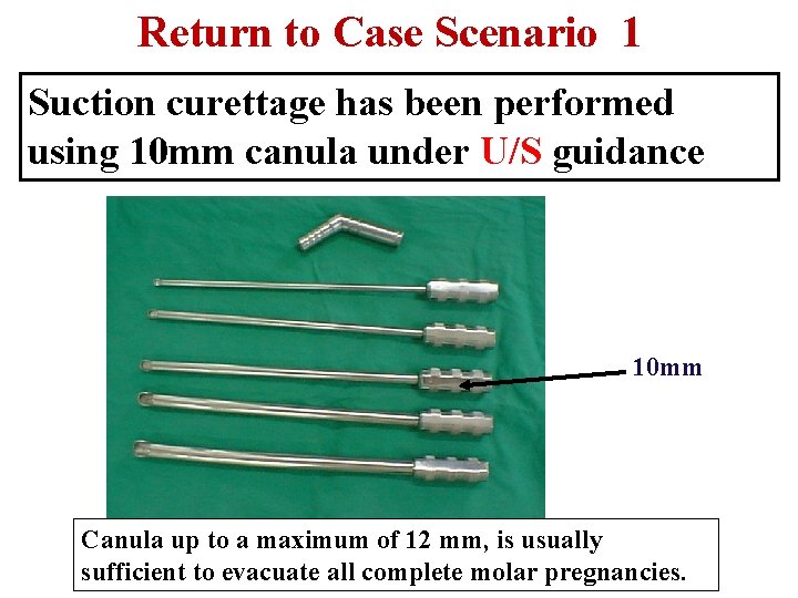 Return to Case Scenario 1 Suction curettage has been performed using 10 mm canula