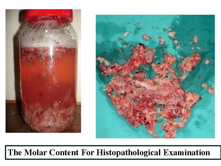 The Molar Content For Histopathological Examination 