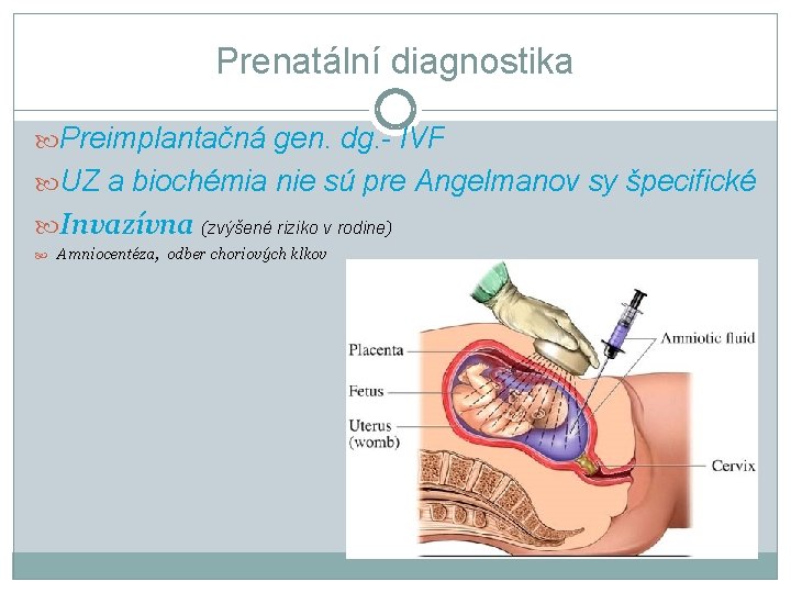 Prenatální diagnostika Preimplantačná gen. dg. - IVF UZ a biochémia nie sú pre Angelmanov