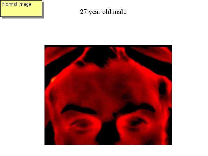 Normal image 27 year old male 