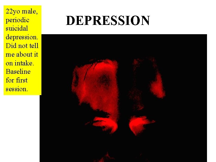 22 yo male, periodic suicidal depression. Did not tell me about it on intake.