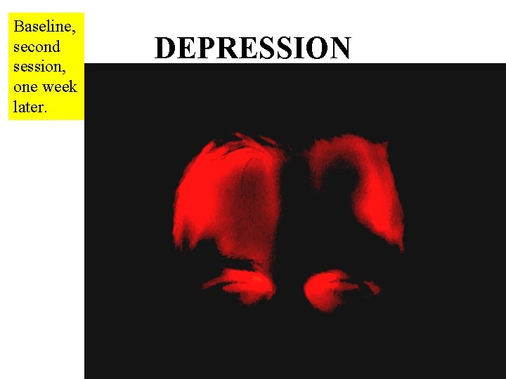 Baseline, second session, one week later. DEPRESSION 
