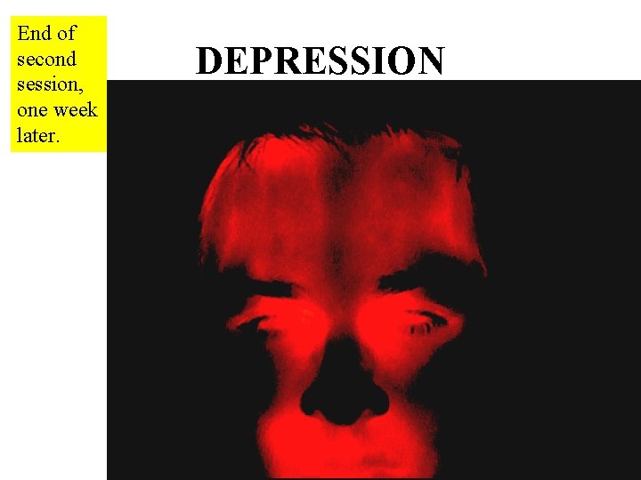 End of second session, one week later. DEPRESSION 