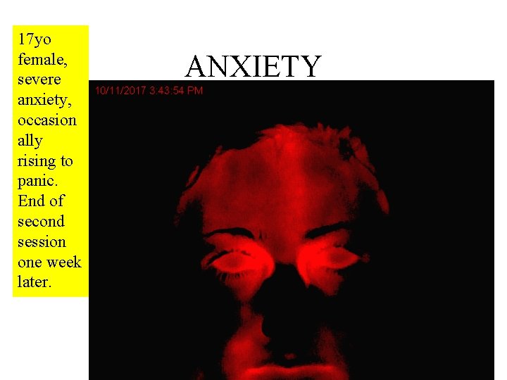17 yo female, severe anxiety, occasion ally rising to panic. End of second session