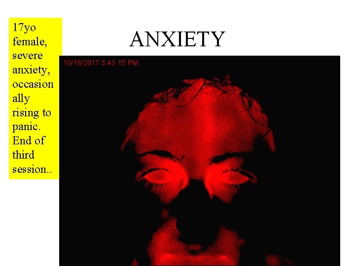 17 yo female, severe anxiety, occasion ally rising to panic. End of third session.