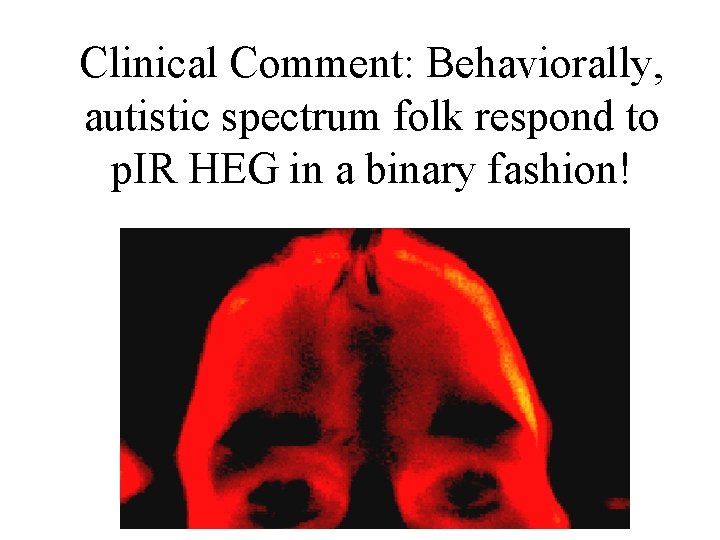 Clinical Comment: Behaviorally, autistic spectrum folk respond to p. IR HEG in a binary