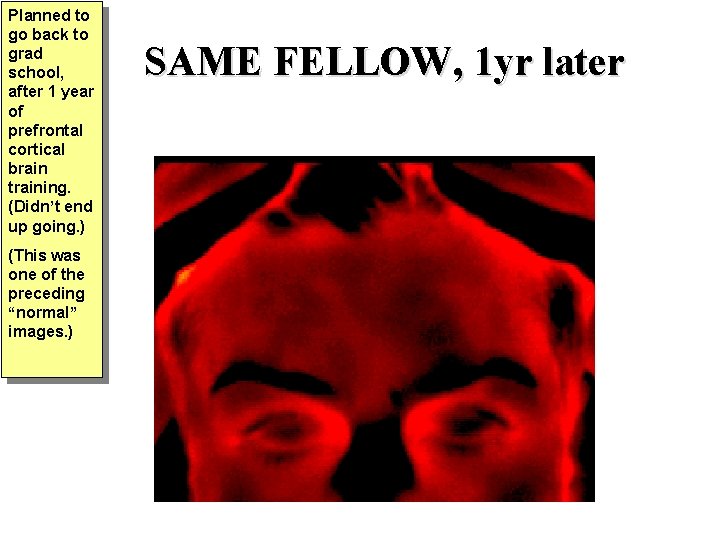 Planned to go back to grad school, after 1 year of prefrontal cortical brain