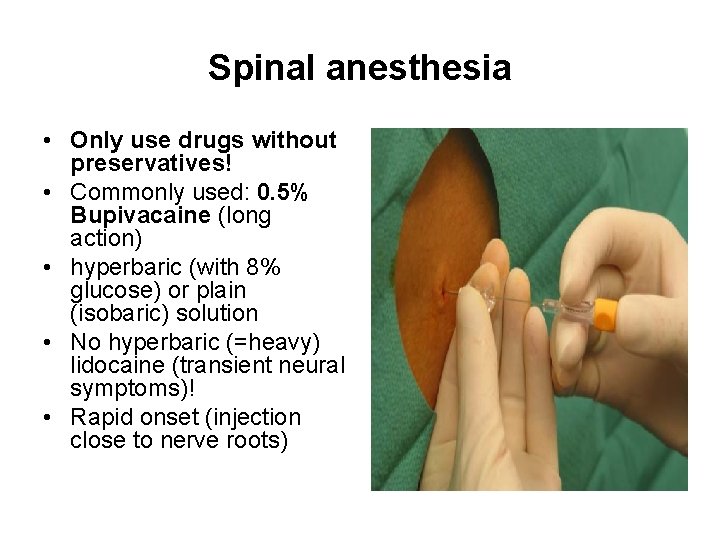 Spinal anesthesia • Only use drugs without preservatives! • Commonly used: 0. 5% Bupivacaine