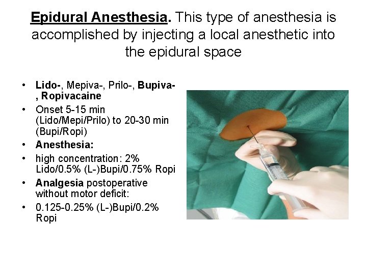 Epidural Anesthesia. This type of anesthesia is accomplished by injecting a local anesthetic into