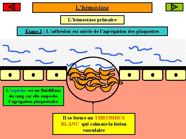 L’hémostase primaire Étape 23: : Les L’adhésion plaquettes estadhèrent suivie deau l’agrégation collagène sous-endothélial