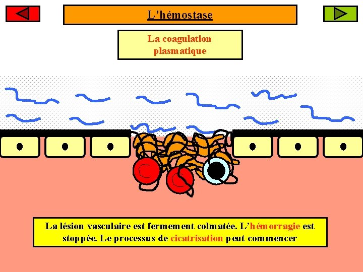 L’hémostase La coagulation sanguine La coagulation plasmatique La lésion vasculaire est fermement colmatée. L’hémorragie