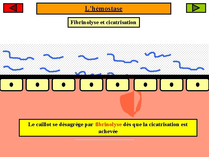 L’hémostase Fibrinolyse et cicatrisation Le caillot se désagrège par fibrinolyse dès que la cicatrisation