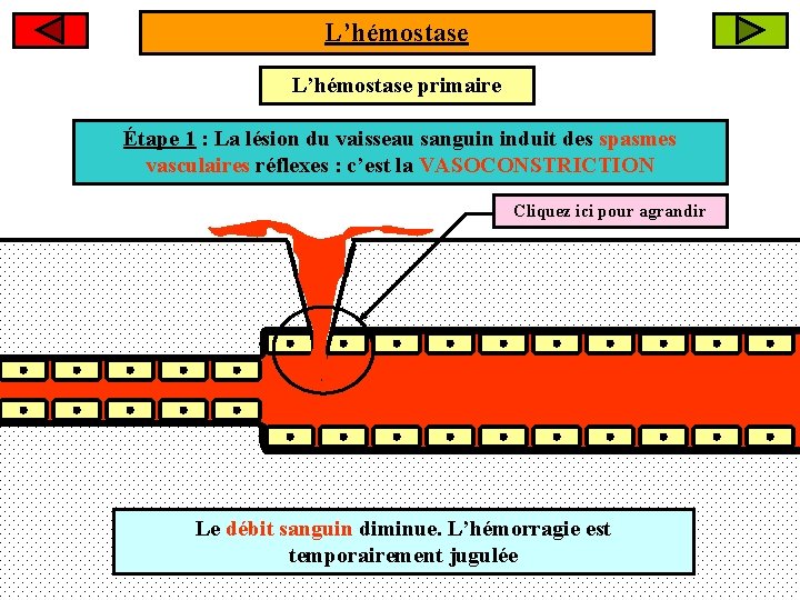 L’hémostase primaire Étape 1 : La lésion du vaisseau sanguin induit des spasmes vasculaires