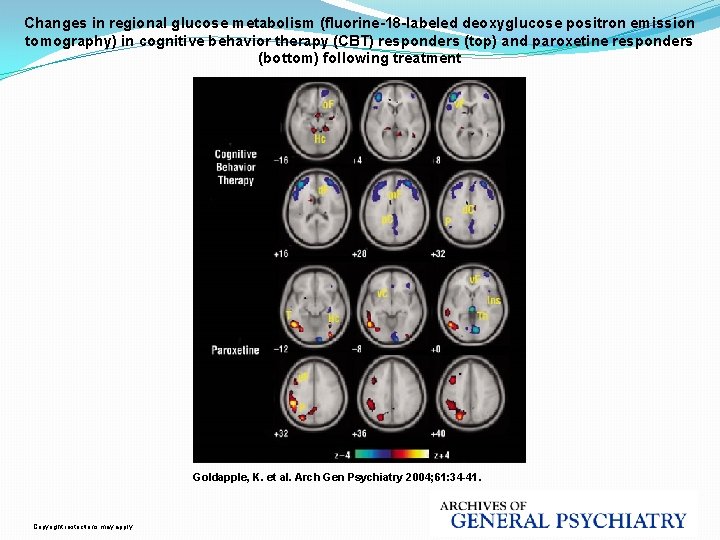 Changes in regional glucose metabolism (fluorine-18 -labeled deoxyglucose positron emission tomography) in cognitive behavior