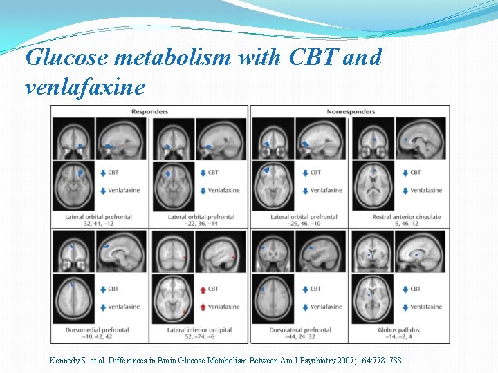 Glucose metabolism with CBT and venlafaxine Kennedy S. et al. Differences in Brain Glucose