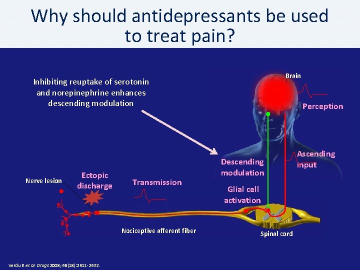 Why should antidepressants be used to treat pain? Brain Inhibiting reuptake of serotonin and