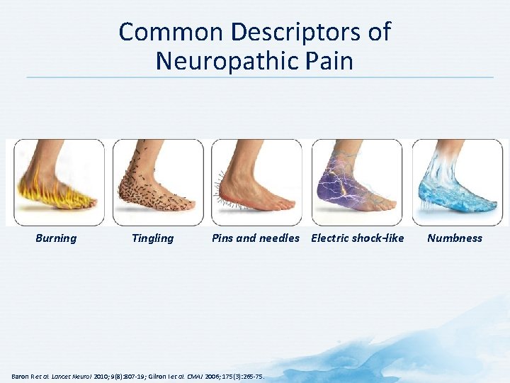 Common Descriptors of Neuropathic Pain Burning Tingling Pins and needles Electric shock-like Baron R