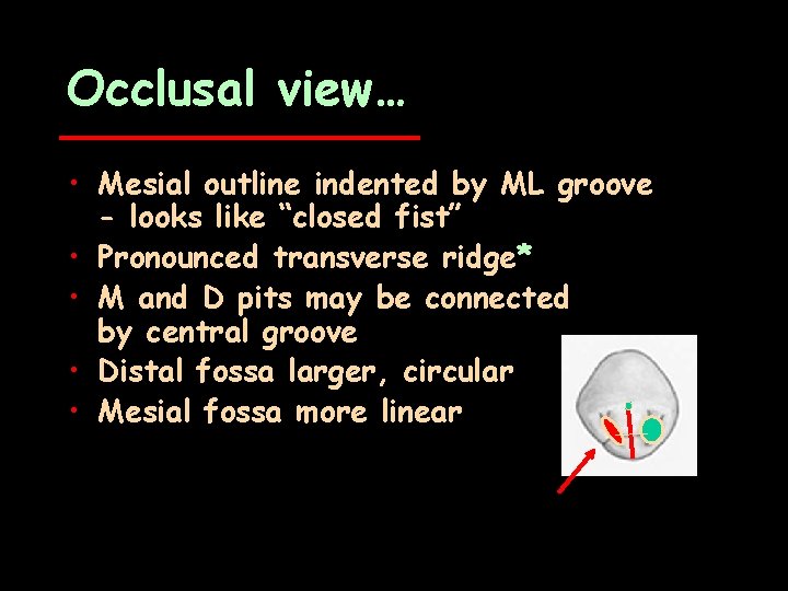 Occlusal view… • Mesial outline indented by ML groove - looks like “closed fist”