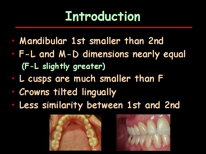 Introduction • Mandibular 1 st smaller than 2 nd • F-L and M-D dimensions