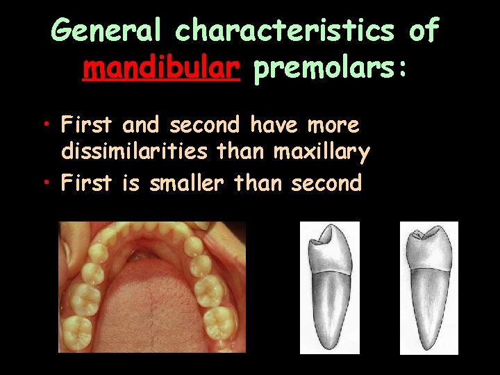 General characteristics of mandibular premolars: • First and second have more dissimilarities than maxillary