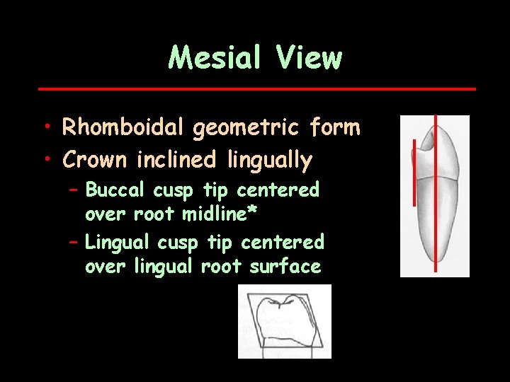 Mesial View • Rhomboidal geometric form • Crown inclined lingually – Buccal cusp tip