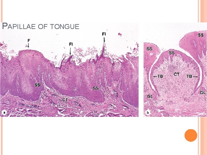 PAPILLAE OF TONGUE PAPILLAE OF TONGUE