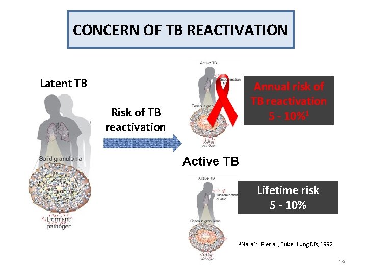 CONCERN OF TB REACTIVATION Latent TB Annual risk of TB reactivation 5 - 10%1